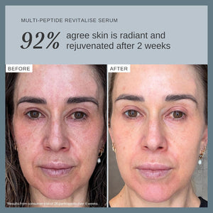 Alpha-H Multi-Peptide Face Serum - Firms & Plumps Fine Lines (30ml) | Peptide Blend Visibly Boosts Bounce & Elasticity, Lightweight, Fragrance-Free, Layers Under Moisturizer, Australian Made