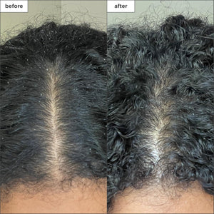 Briogeo Scalp Revival Charcoal + Coconut Oil Micro-Exfoliating Shampoo | Sulfate-Free Scalp Scrub for Dry, Itchy, or Oily Scalp | Detoxifying & Hydrating | Vegan & Cruelty Free