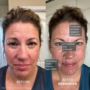 Seranova Micro Infusion for Skin Care, Facial Moisturizing Essence, Serum Smooth Skin Facial Serum for All Skin Types, 1-Month Supply