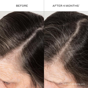 ZENAGEN Densifying Hair Serum for Fine + Thinning Hair | Boosts Hair Density, Strengthens & Nourishes Hair Follicles, Non-Greasy Water-Based Formula, Plant-Based, Vegan, All Hair Types