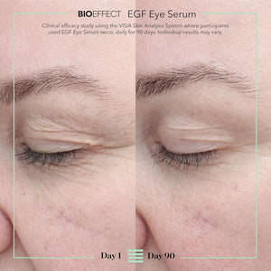 BIOEFFECT EGF Eye Serum with De-Puffer Rollerball | Age-Defying Under Eye Treatment with Epidermal Growth Factor for Fine Lines, Wrinkles, Puffiness & Sagging 6 mL / 0.20 oz