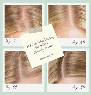 Saw Palmetto Follicle Boost Scalp Serum for Thinning Hair, Clinically Tested Hair & Scalp Treatment, Drug-Free Hormone-Free, Non-Greasy Formula with Peptides, Caffeine & Biotin